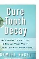 Dagaanbieding Cure Tooth Decay Remineralize Cavities and Repair Your Teeth Naturally with Good Food - Ramiel Nagel - Libro in lingua inglese - Golden Child Publishing -